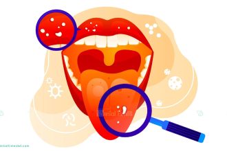 ৩ দিন ব্যাপী মুখের ক্যান্সার ' স্ক্রীনিং প্রোগ্রাম ' &raquo; DENTAL TIMES