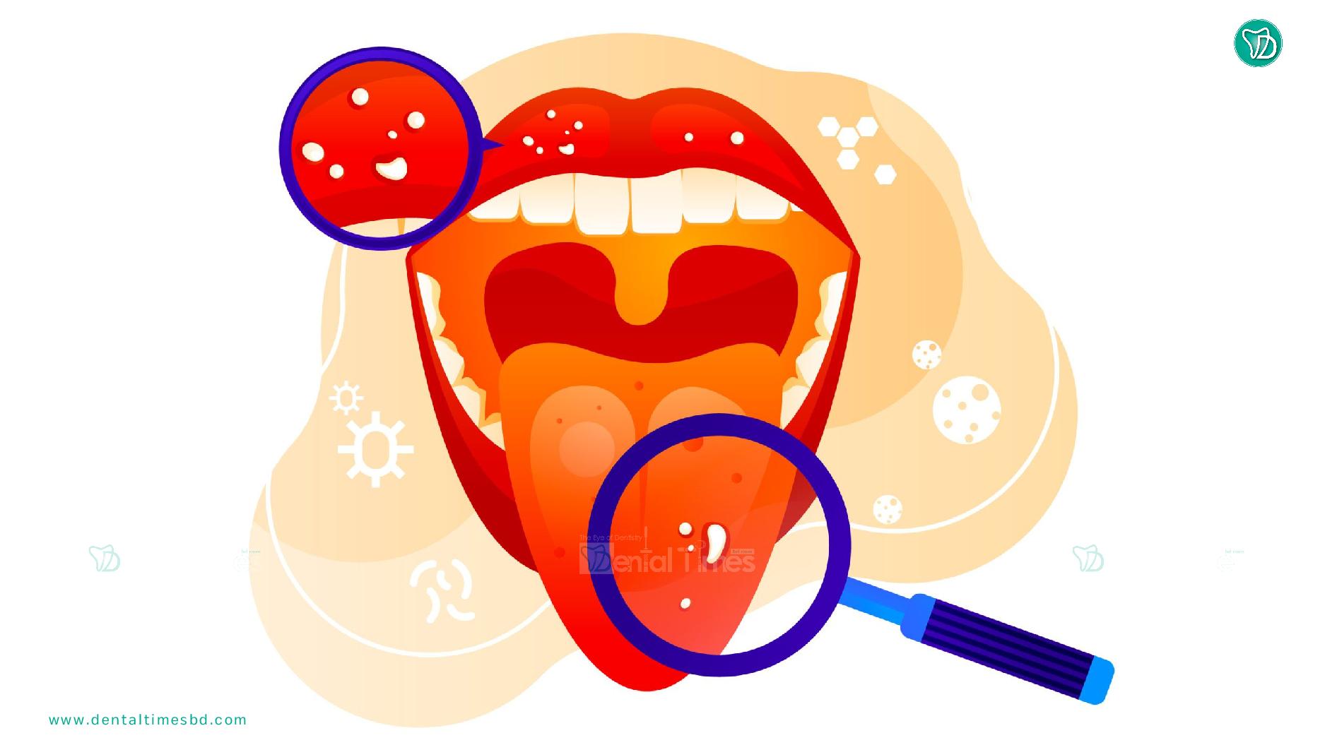 ৩ দিন ব্যাপী মুখের ক্যান্সার ' স্ক্রীনিং প্রোগ্রাম ' &raquo; DENTAL TIMES